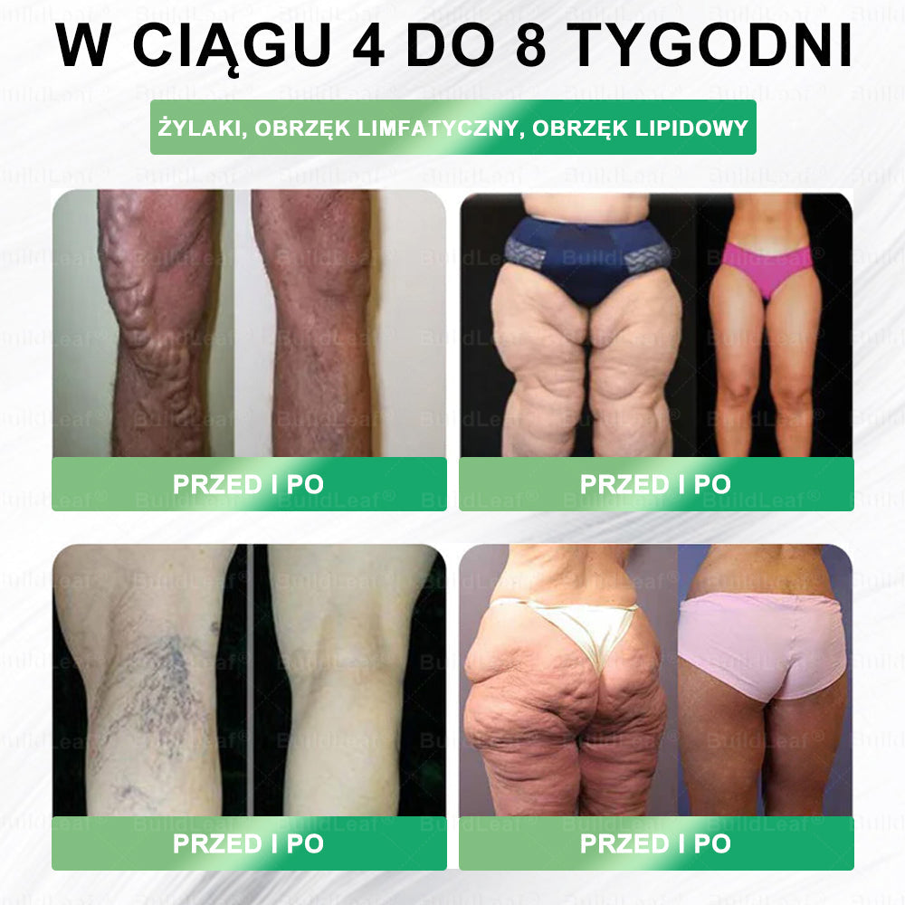 🍃Oficjalny sklep Polska | · (Jednorazowe dziennie, widoczne zmiany w ciągu 7 dni) ✅ Otyłość, zdrowie sercowo-naczyniowe, cukrzyca, bezdech senny, zdrowie jelit, problemy ze stawami i inne.
